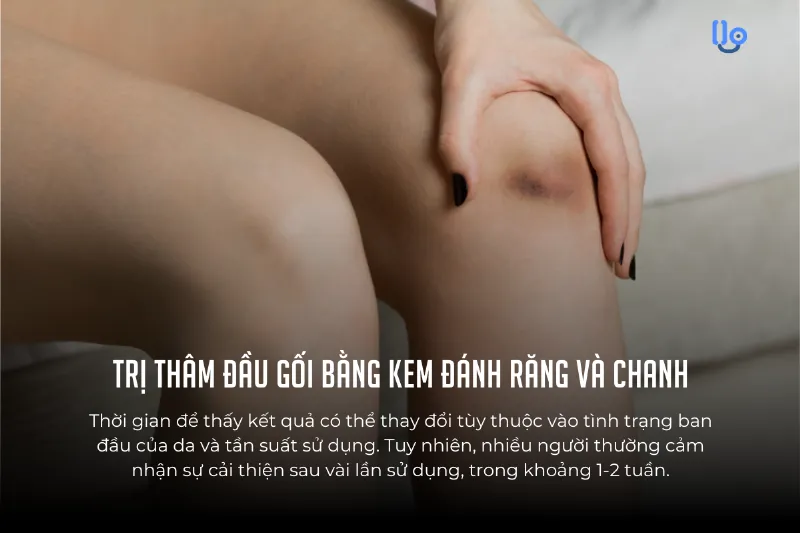 Da đầu gối khô ráp, thiếu độ ẩm