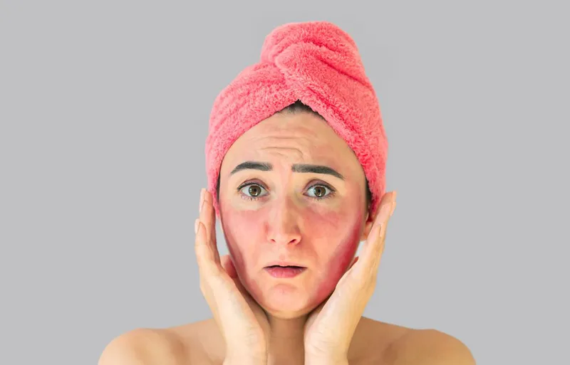 Lưu ý khi sử dụng dầu dừa