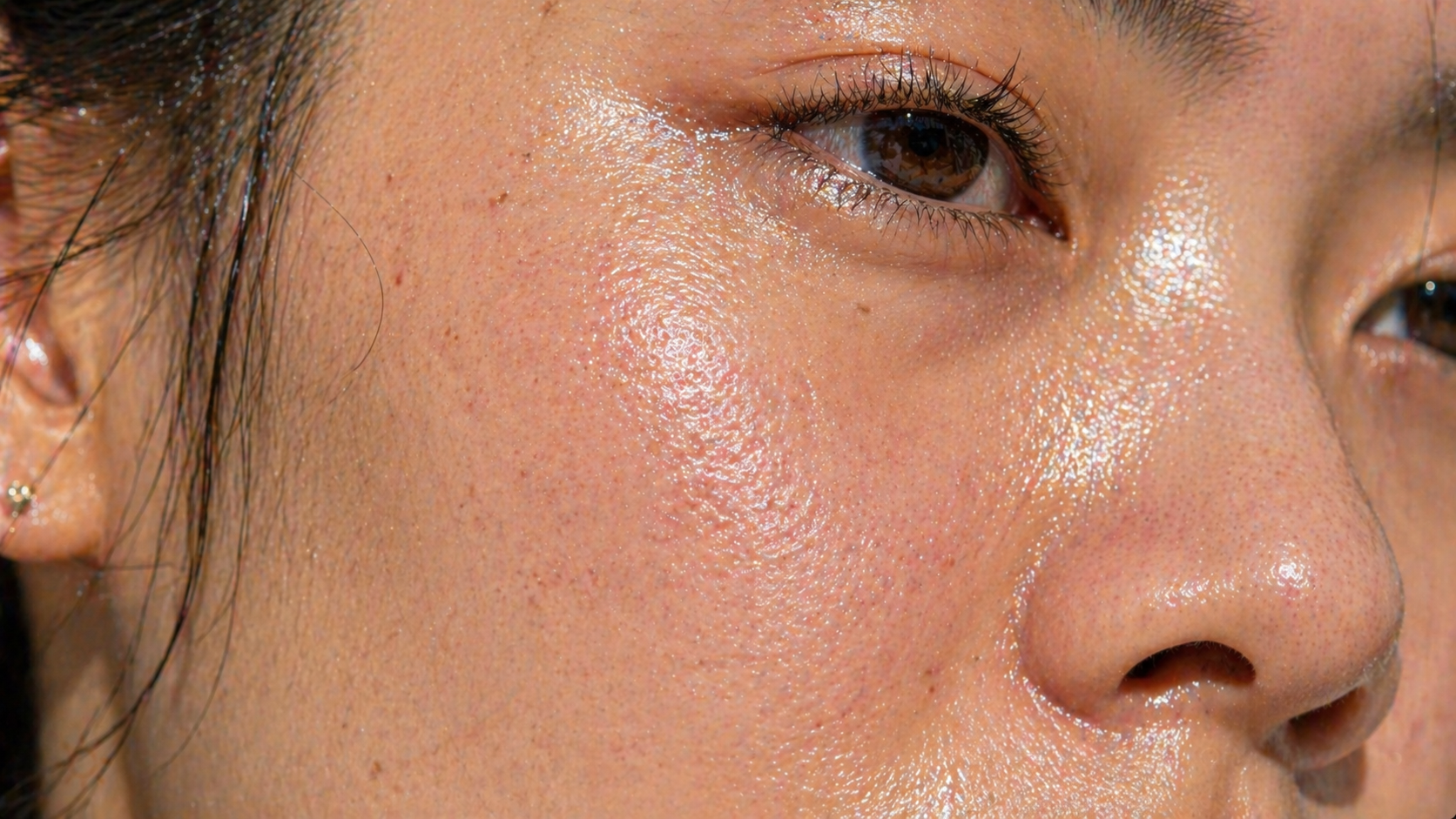 Cận cảnh lỗ chân lông và tuyến bã nhờn hoạt động khi bôi kem chống nắng kiềm dầu sai cách